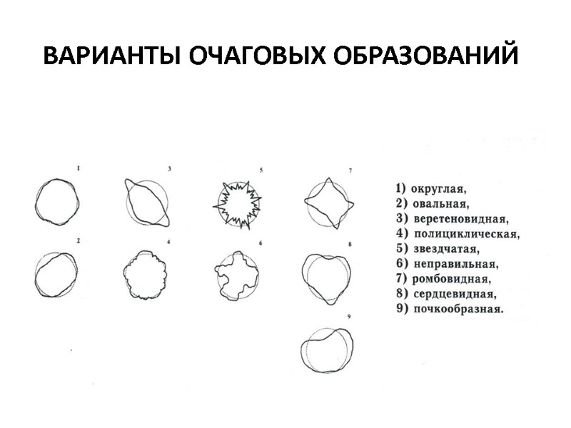 ВАРИАНТЫ ОЧАГОВЫХ ОБРАЗОВАНИЙ